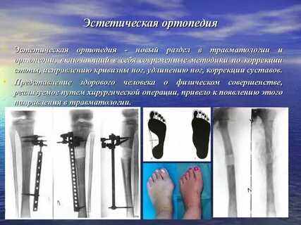 Травматологическо ортопедической