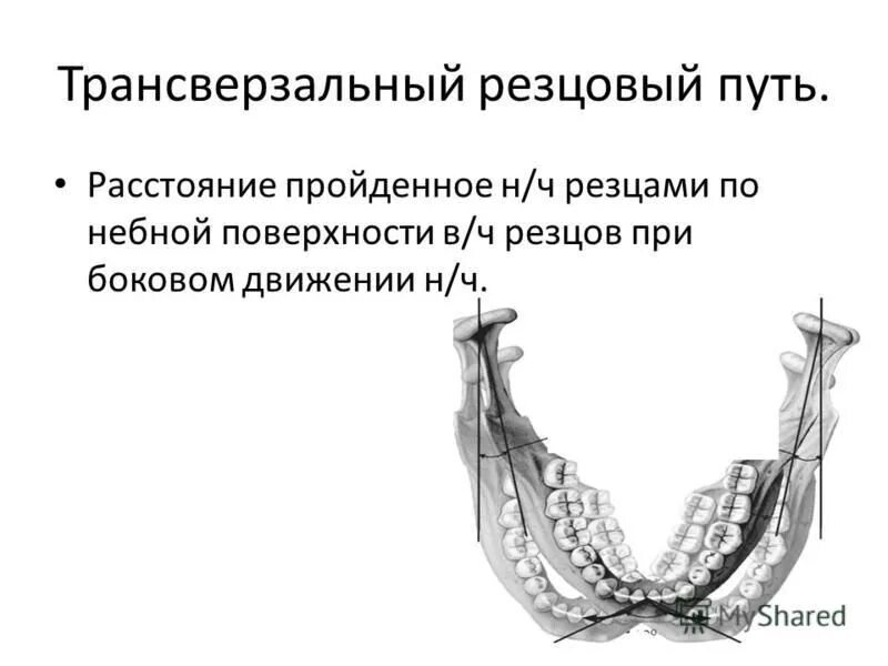 угол трансверзального резцового. трансверзальный суставной путь. трансверзального резцового пути. угол трансверзального резцового. чему равен угол трансверзального резцового пути.