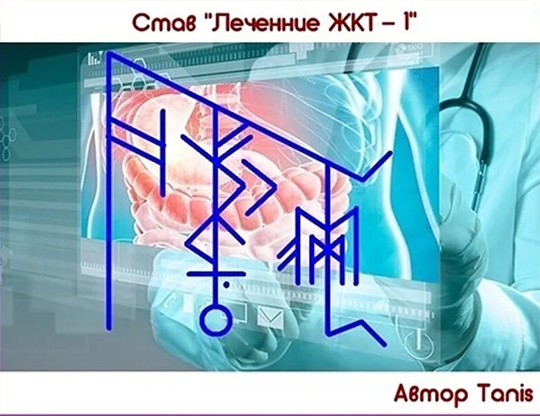 Исцеление желудка. Став "леченние ЖКТ " Автор tanis. Став исцеление желудка. Ставы для лечения желудка. Руны от болезни желудка.