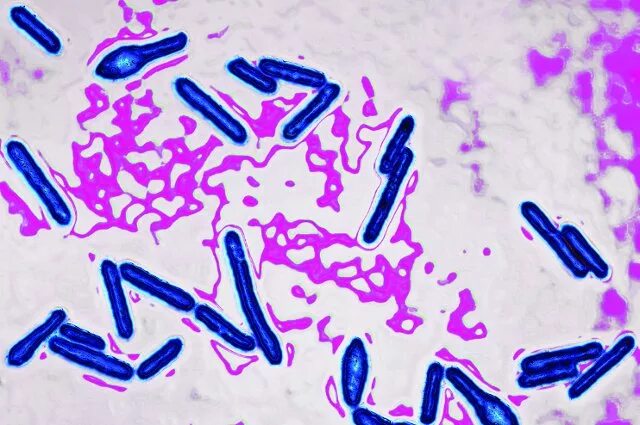 Clostridium spp. Клостридии ботулизма ( Clostridium botulinum ) ботулизм. Бактерии клостридиум. Клостридия ботулинум микробиология. Палочки ботулизма Clostridium botulinum.