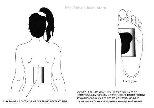 горчичники и перцовый пластырь. куда клеить пластырь при бронхите. перцовый пластырь при кашле. активные точки при кашле схема. пластырь при кашле.
