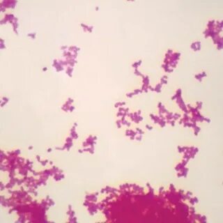 Klebsiella oxytoca