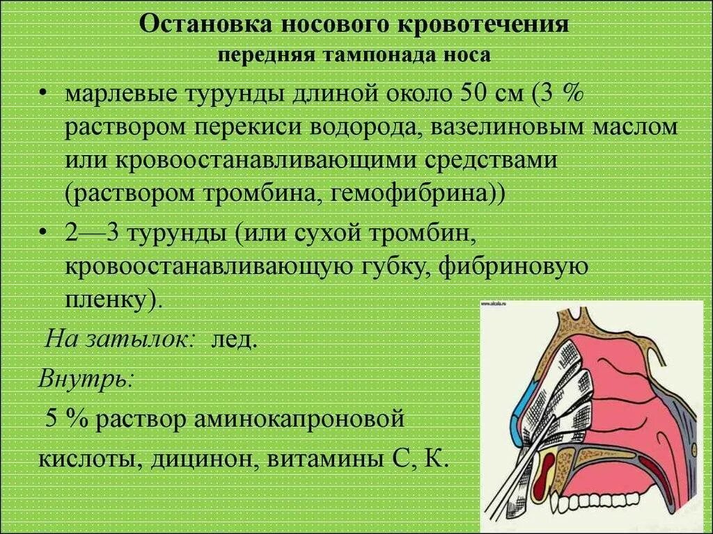 Острое носовое кровотечение. Остановка носового кровотечения. Остановка родового кровотечения. Остановка кровотечения из носа. Причины носового кровотечения.