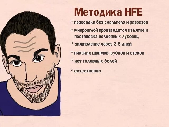 Технология трансплантации волос HFE. Пересадка волос методом HFE. Технология трансплантации волос HFE схема.