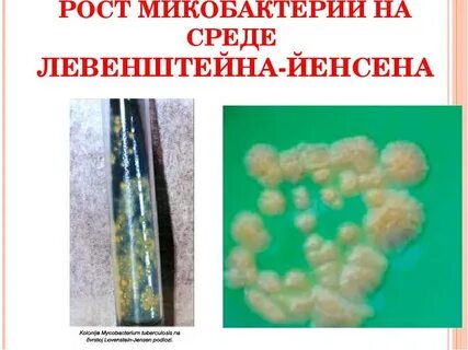 Среда для микобактерий туберкулеза