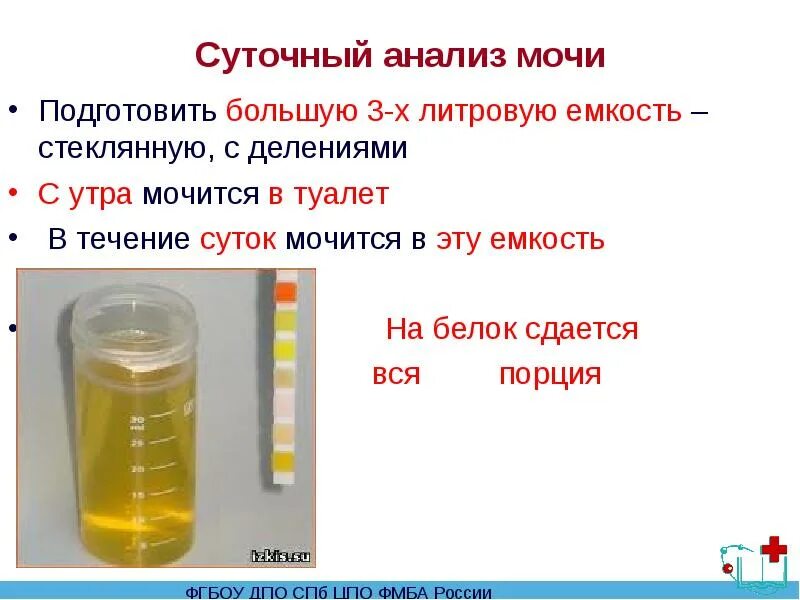 Отсутствие белка в моче. Емкость для сдачи суточного анализа мочи. Как сдавать суточный анализ мочи. Суточный сбор мочи для анализа. Анализ мочи суточный как собирать правильно.