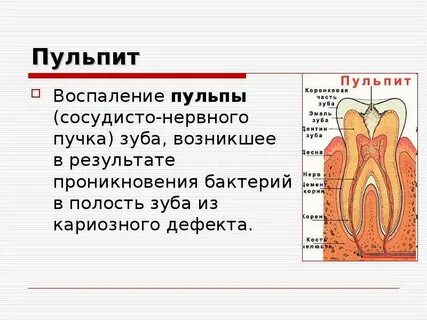 Пульпа представляет собой
