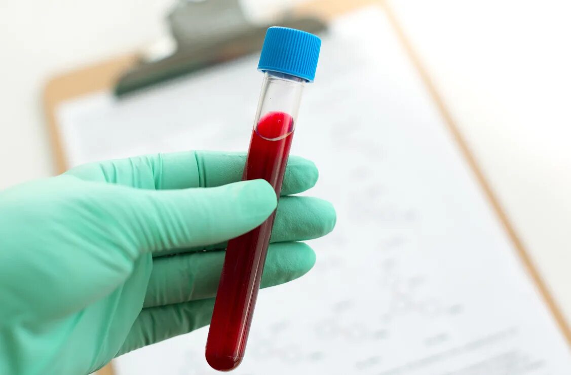 Биохимия крови методика исследования. Лабораторные исследования крови. Биохимия из пальца. Лаборатория крови. Биохимия из пальца.