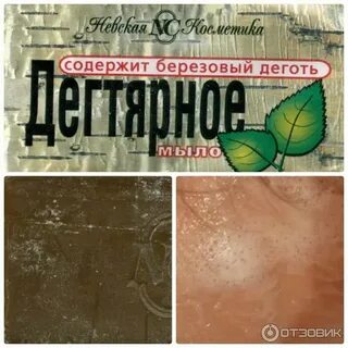 Дегтярное от прыщей