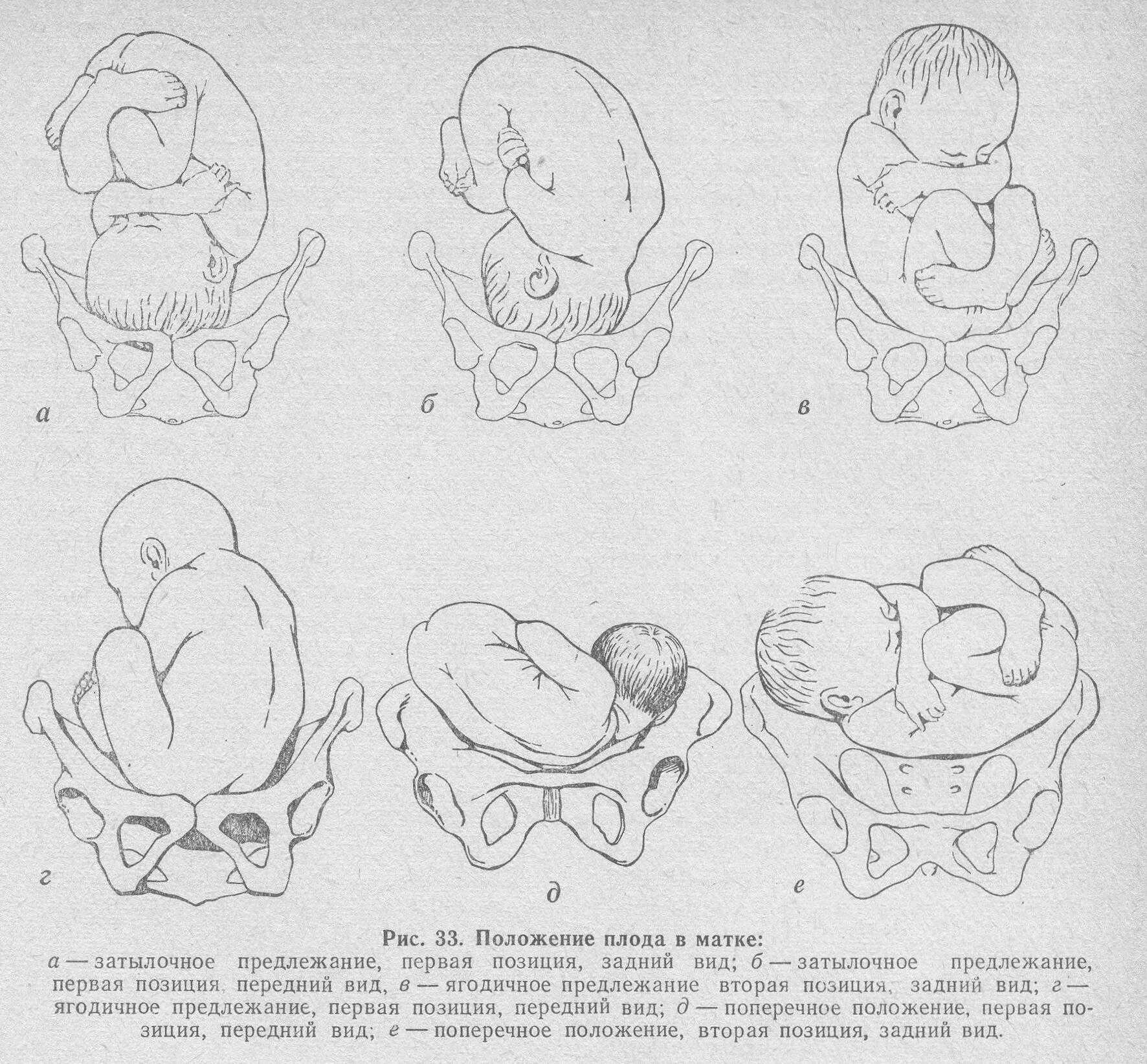 Что означает предлежание. Положение плода в полости матки. Вид позиция предлежание плода. Ягодичное предлежание 2 позиция передний вид. Положения прилежания позиции плода.