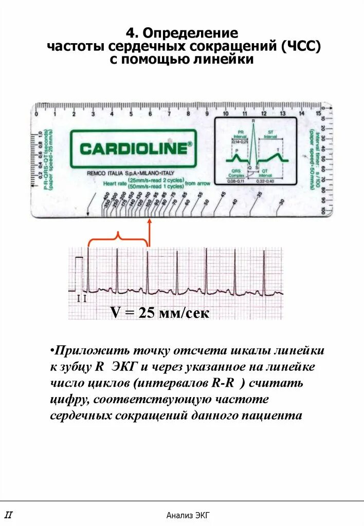 Подсчет сердечных сокращений человека название метода. Подсчет чсс на экг. подсчёт чсс по экг 25 мм. подсчет чсс на экг 50 мм/с. линейка экг.