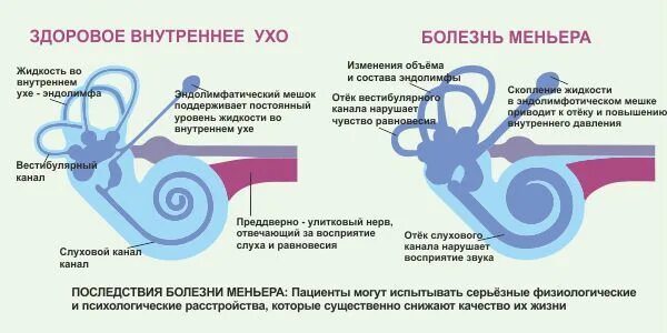 Как проверить ухо при головокружении