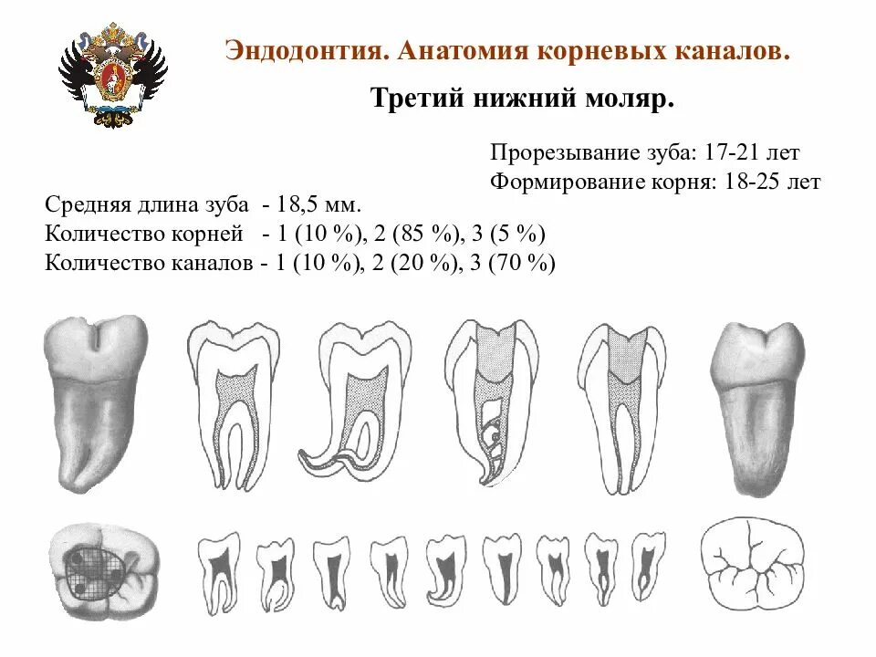 Верхние и нижние каналы. Третий моляр нижней челюсти корни. Верхний 1 моляр анатомия корневых каналов. 3 Нижний моляр анатомия. Анатомия зубов верхней челюсти каналы.