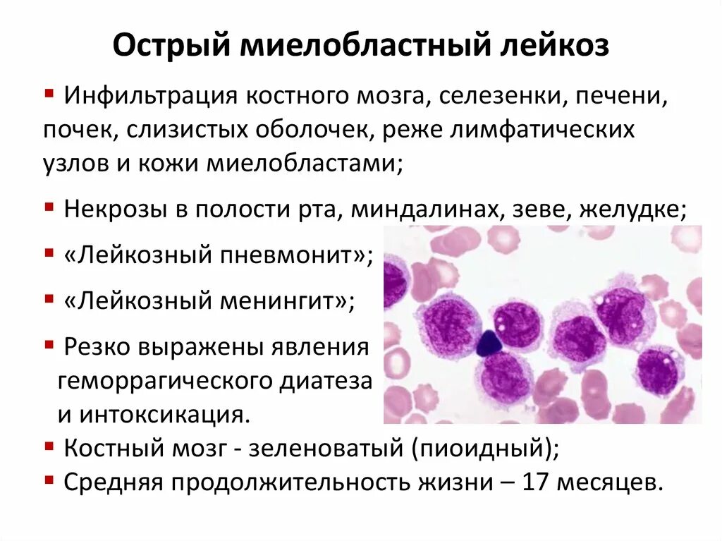 Острый миелоидный лейкоз прогноз. Острый миелобластный лейкоз картина костного мозга. Миелоидный лейкоз картина крови. Острый и хронический миелобластный лейкоз. Острый миелоидный лейкоз м0.