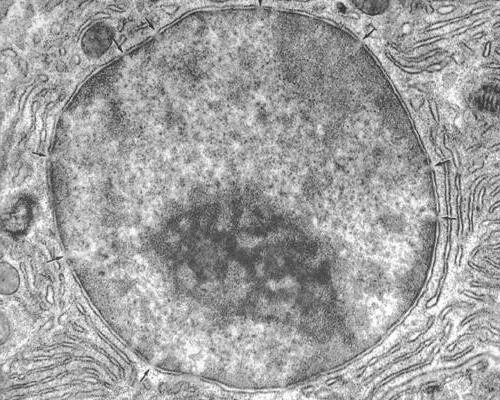 строение хлоропласта электронная микрофотография. электронограмма эпс. электронная микрофотография митохондрии. электронограмма хлоропласта. электронная микрофотография хлоропласта.