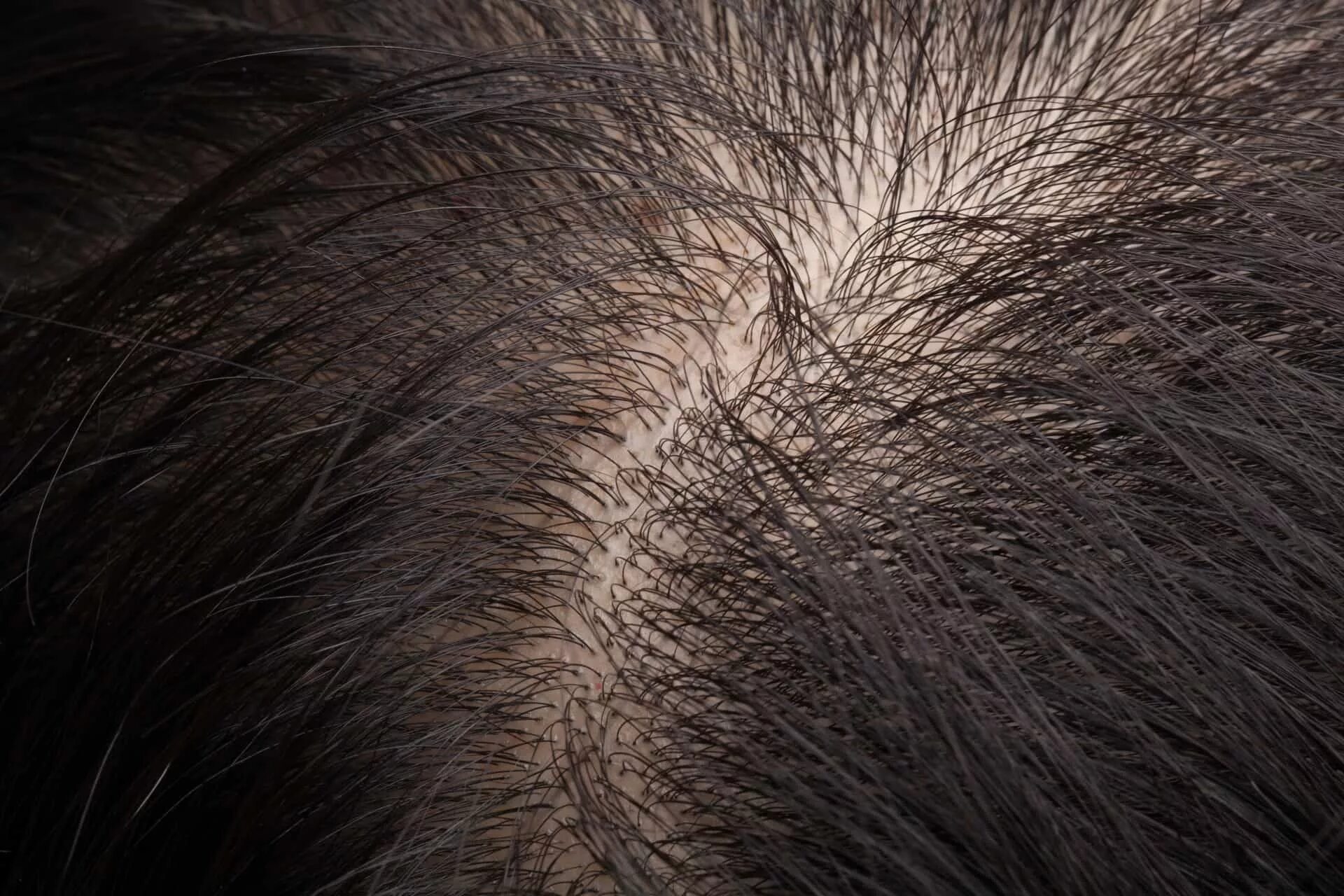Волосы человека. Картинка волосы человека. Текстура кожи головы.