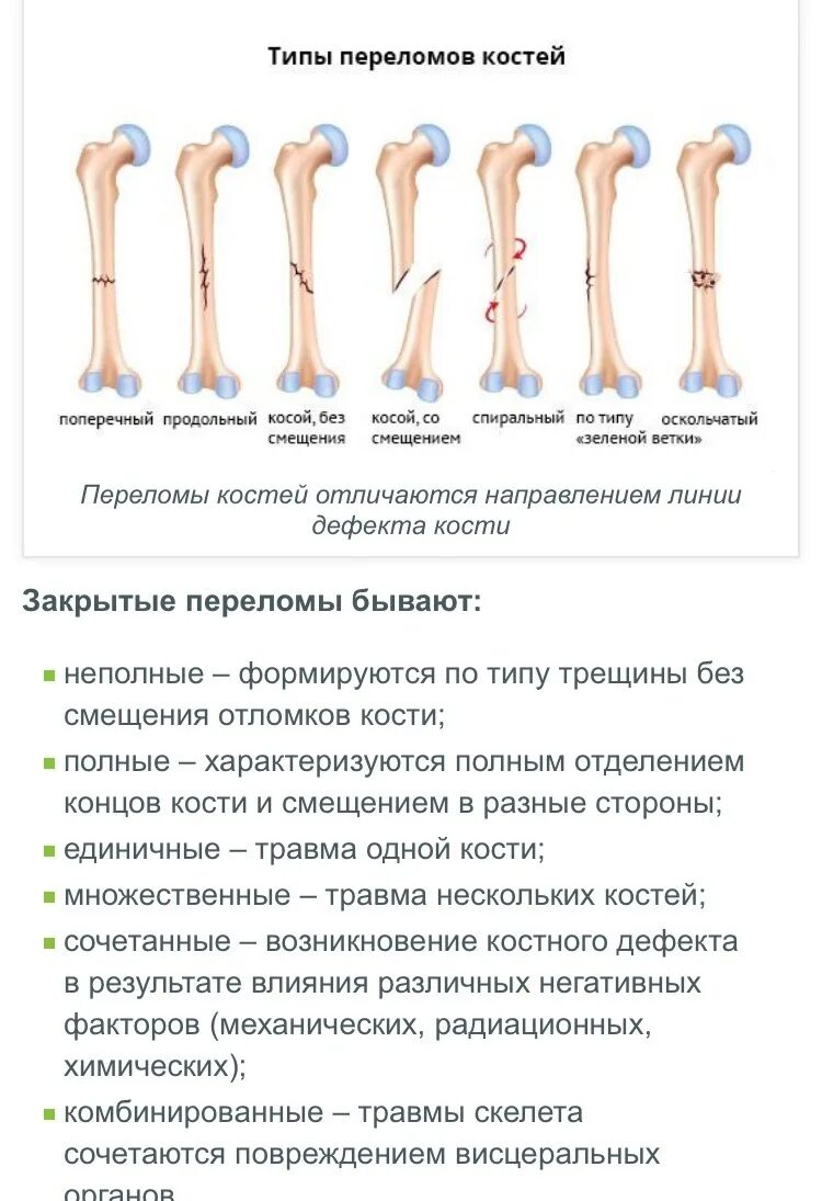 Типы закрытых переломов. Переломы длинных трубчатых костей. Характеристика переломов костей. Таблица переломов костей.