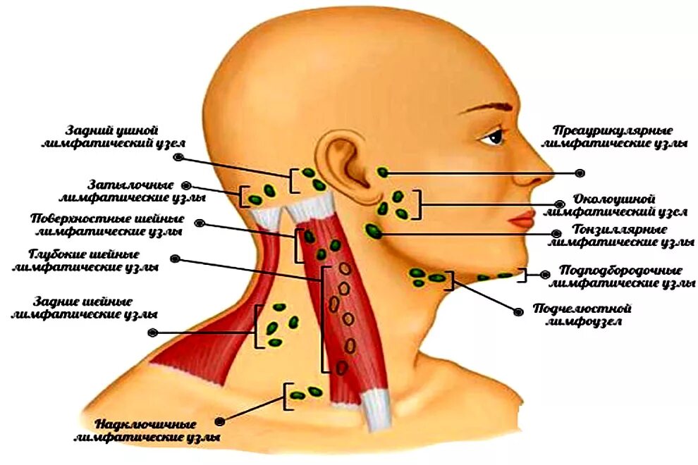 Причины увеличения лимфатических узлов. Заднешейные лимфатические узлы. Воспаление лимфатические узлы шеи. Околоушные лимфатические узлы схема. Лимфоузлы околоушные схема.