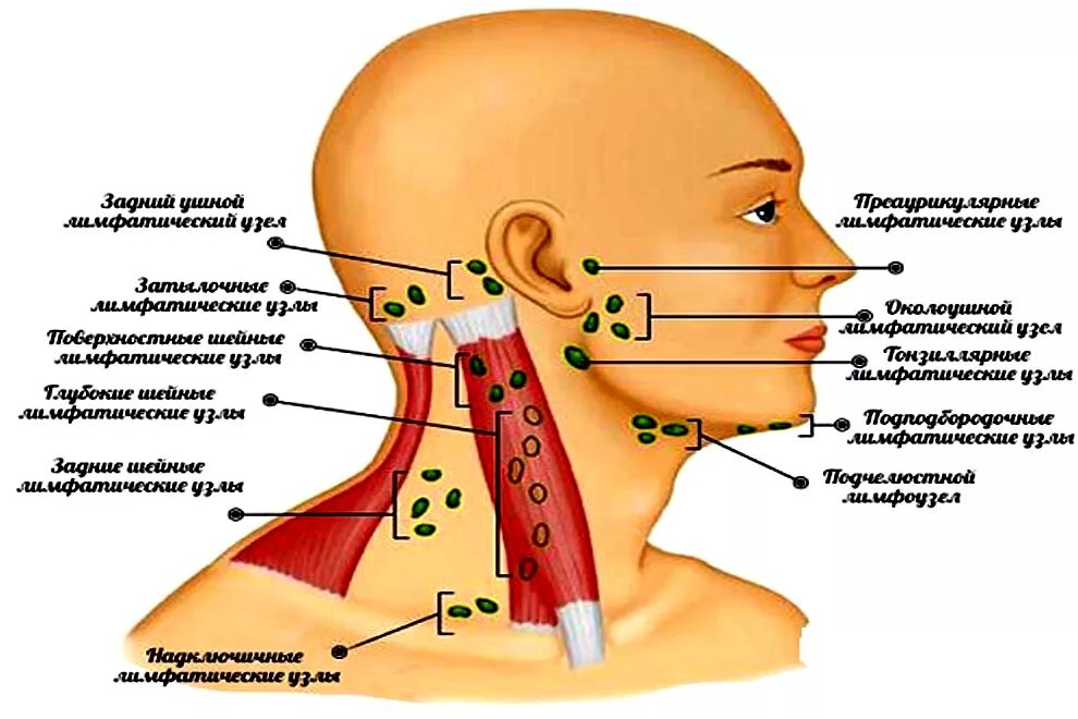 Как правильно лимфоузел. Заднешейные лимфатические узлы. Воспаление лимфатические узлы шеи. Околоушные лимфатические узлы схема. Лимфоузлы околоушные схема.