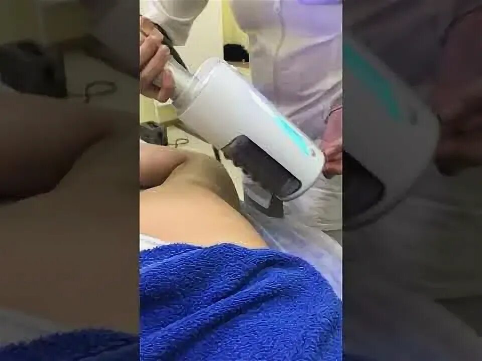 Эндосфера лица отзывы результаты фото RSL скульптурирование