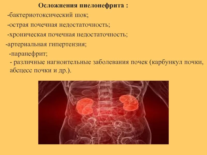 Пиелонефрит температура 38. Осложнения хронического пиелонефрита, клинические проявления.. Осложнения при остром пиелонефрите. Последствия острого пиелонефрита. Осложнением хронического пиелонефрита является.