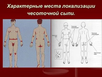 Таксодермия