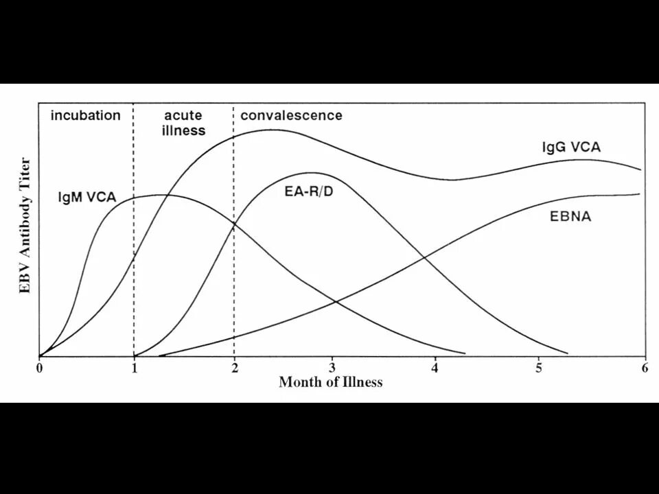 Динамика антител при инфекционном мононуклеозе. Антитела к вирусу Эпштейна Барр. Динамика антител при вэб инфекции. Антитела к инфекционному мононуклеозу интерпретация. Вэб иммуноглобулины