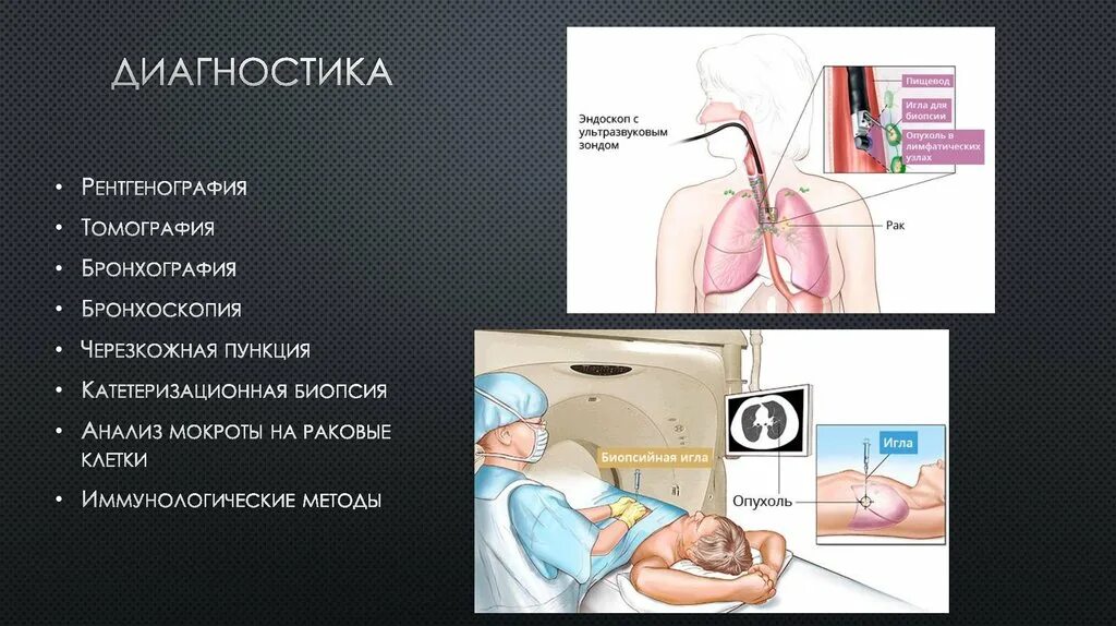 Бронхоскопия мокроты. Катетеризационная трансбронхиальная биопсия. Бронхоскопия и бронхография. Бронхография и бронхоскопия отличие. Бронхоскопия и опухоль легкого.