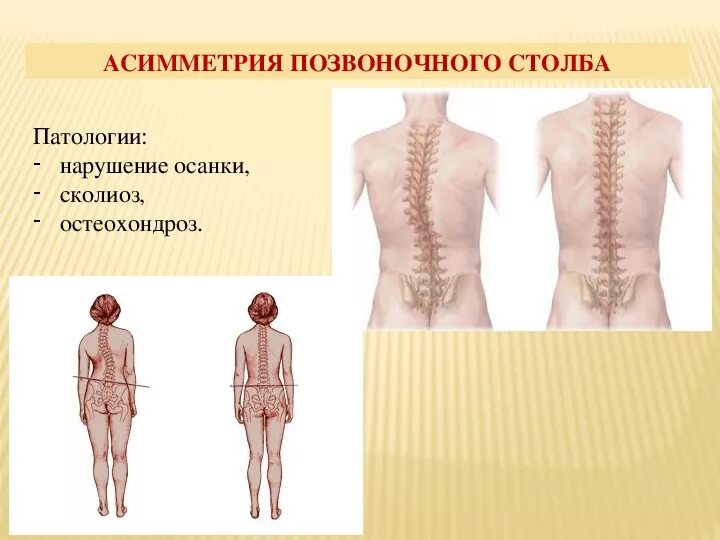 Симметричное заболевание. Симметрия туловища. Симметрия тела человека. Асимметрия. Асимметрия тела человека.