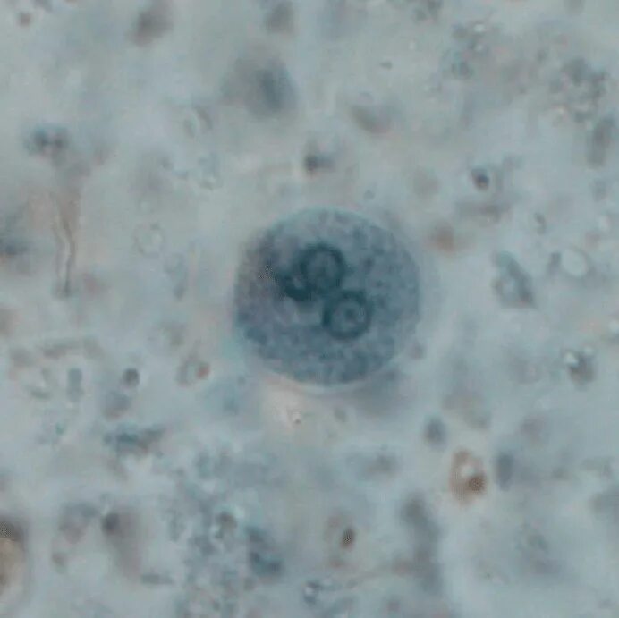 Entamoeba coli в кале. Цисты Entamoeba. Entamoeba coli циста. Entamoeba dispar цисты. Entamoeba histolytica.