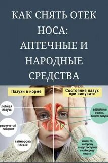 Отек в носу без соплей у взрослого