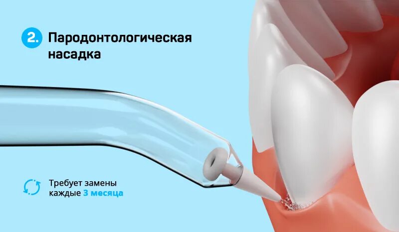 Ирригатор насадка для имплантов. Пародонтологическая насадка для ирригатора. Ирригатор для имплантов и коронок. Насадка для ирригатора для имплантов. Имплантационная насадки для ирригатора.