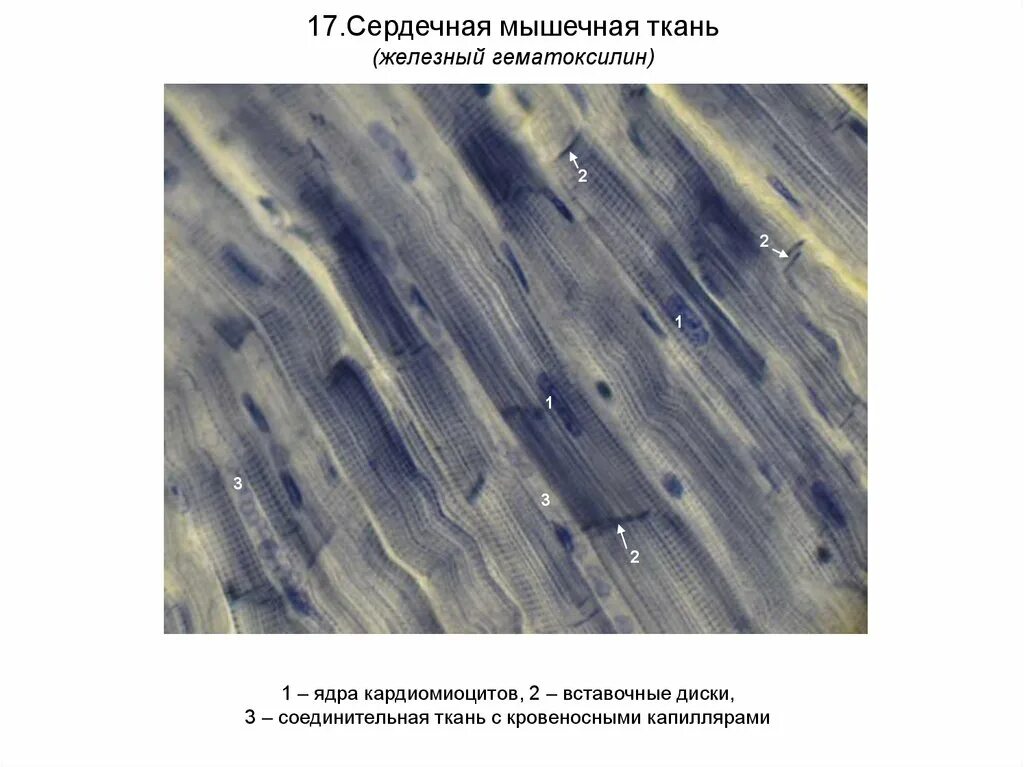 Сердечная ткань миокарда. Сердечная мышечная ткань железный гематоксилин. препарат миокард железный гематоксилин. миокард препарат гистология железный гематоксилин. поперечно полосатая сердечная мышечная ткань железный гематоксилин.