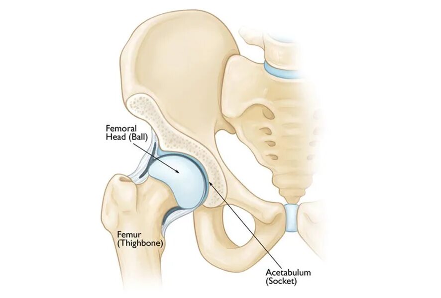 Анатомия вертлужной впадины. Импинджмент тазобедренного сустава. Фемороацетабулярный импинджмент тазобедренного. Вертлужная впадина тазобедренного сустава. Тазобедренные суставы производители