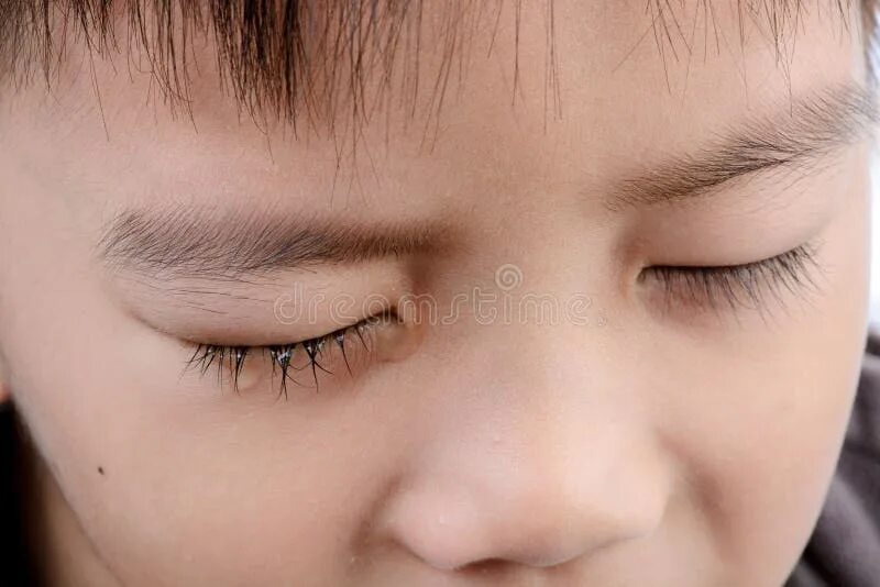 Попал песок в глаза ребенку что делать. Слезится 1 глаз у ребенка. Картинка ощущение песка в глазах. Попадание песка в глаза.
