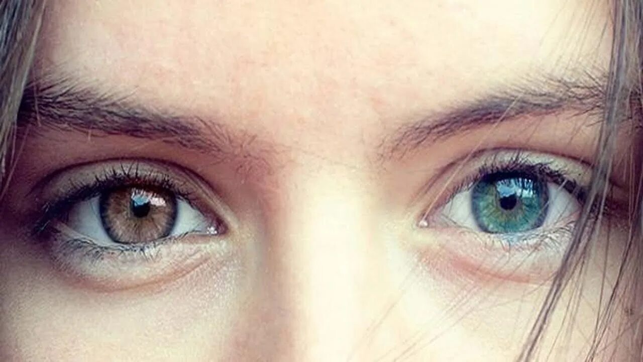 Один глаз серый другой. Гетерохромия карие. Гетерохромия голубой и Карий. Гетерохромия Радужки глаз. Гетерохромия зеленый и Карий.