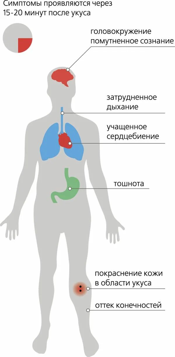 Симптомы укусов змей. Симптомы после укуса гадюки. Последствия после укуса змей.