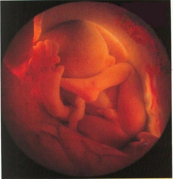 28 акушерских недель. Ребенок в утробе 28 недель беременности. Малыш на 28 неделе беременности в утробе. Плод в 27-28 недель беременности.
