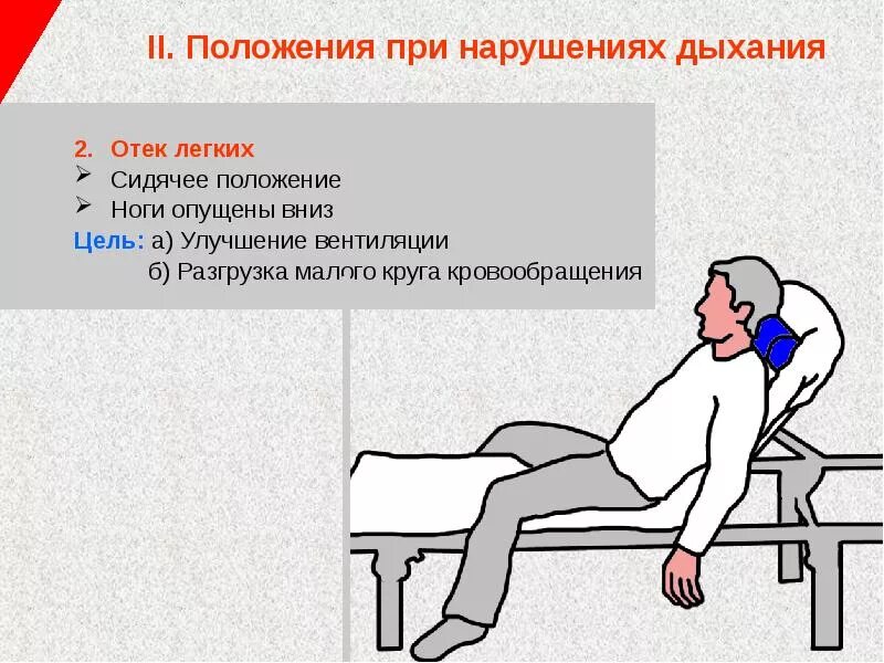 Нарушение правил пациентом. Оптимальное положение для больного с отеком легких. Оптимальное положение тела при отеке легких. Положение больного при отеке легких. Положение пациента при отёке лёгких.