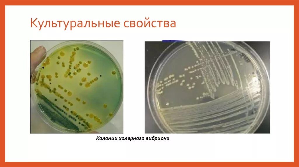 Холера питательные среды. Холерный вибрион на питательных средах. Колонии холерного вибриона на щелочном агаре. Рост холерного вибриона на щелочном агаре. Холерный вибрион морфология культуральные свойства.