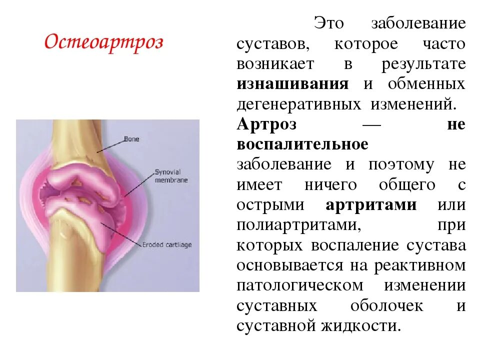 Больные суставы болезнь. Остеоартроз это заболевание. Остеоартроз периферических суставов.