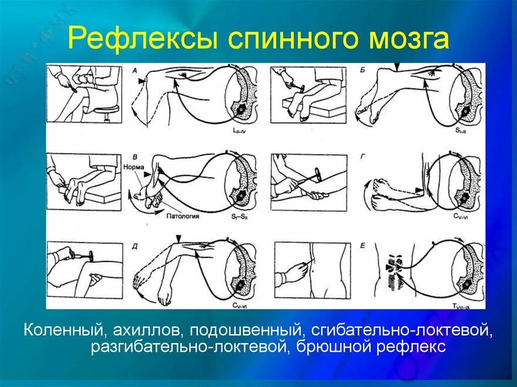 Как проверить рефлексы. Сухожильные рефлексы неврология. Локтевой сухожильный рефлекс. Сухожильные рефлексы человека и методы их оценки. Сухожильные рефлексы рефлексов.