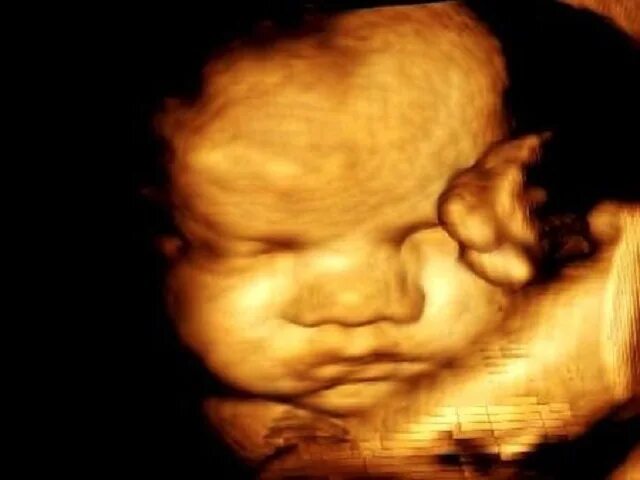 3д узи на 32 неделе беременности. 3д плод. узи 4д в третьем триместре беременности. 3д плод.