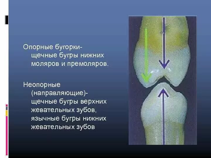 Уровень тольятти бугорок
