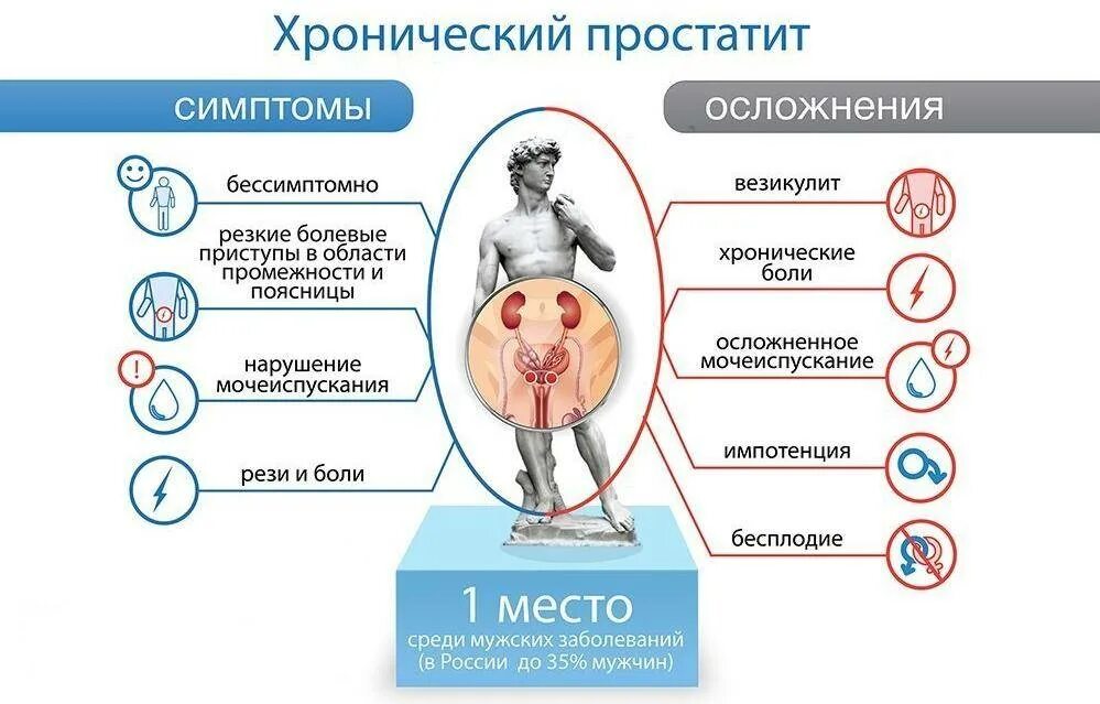 Последствие простаты. Хронический простатит. Хронический простатит симптомы. Симптомы простатита у мужчин.