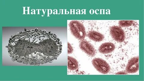 1 вирус оспы
