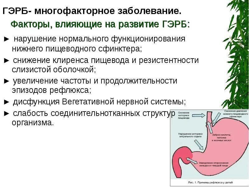 Рефлюксная болезнь пищевода