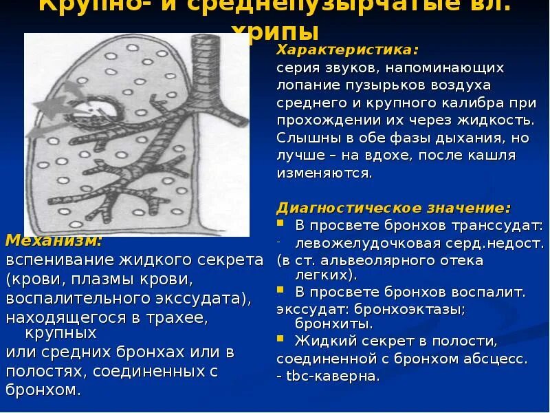 Лопающиеся пузырьки при дыхании. Крупно и среднепузырчатые хрипы. Среднепузырчатые хрипы. Крупнопузырчатые хрипы в легких заболевание. Влажные крупнопузырчатые хрипы.