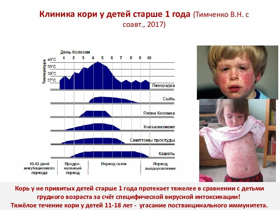 Корь клиника и диагностика. Корь клиника профилактика. Корь в самаре