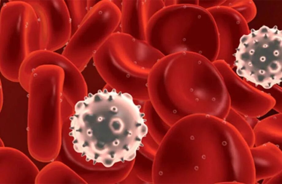 Раковые клетки в крови. Гематобластоз. Опухоль клеток крови